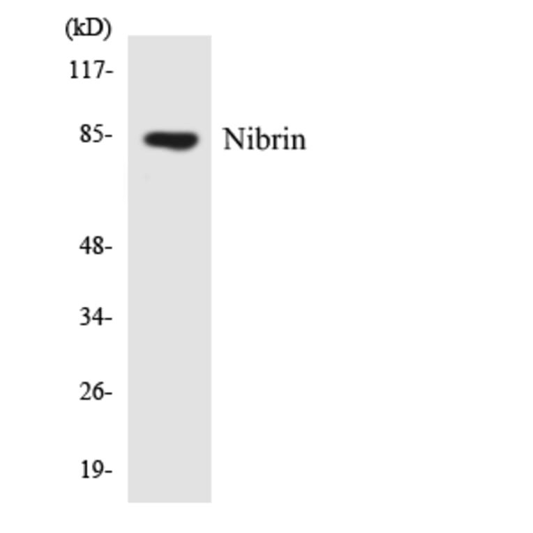 Western Blot - Anti-Nibrin Antibody (R12-3092) - Antibodies.com
