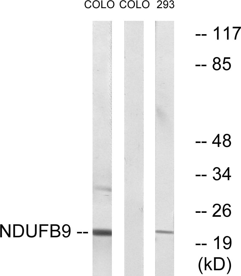 Western blot analysis of lysates from COLO205 cells and 293 cells using Anti-NDUFB9 Antibody. The right hand lane represents a negative control, where the antibody is blocked by the immunising peptide.