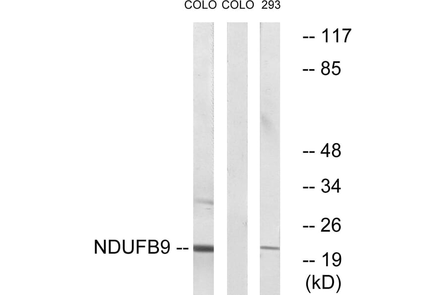 Western Blot - Anti-NDUFB9 Antibody (C16838) - Antibodies.com