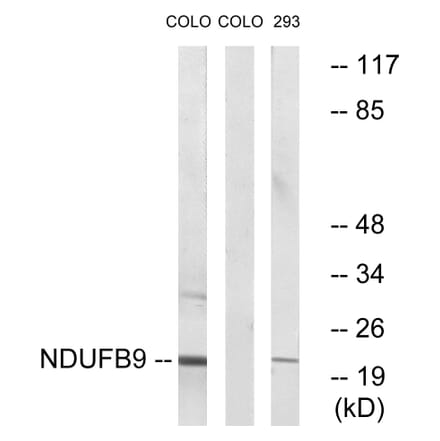 Western Blot - Anti-NDUFB9 Antibody (C16838) - Antibodies.com