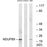 Western Blot - Anti-NDUFB9 Antibody (C16838) - Antibodies.com