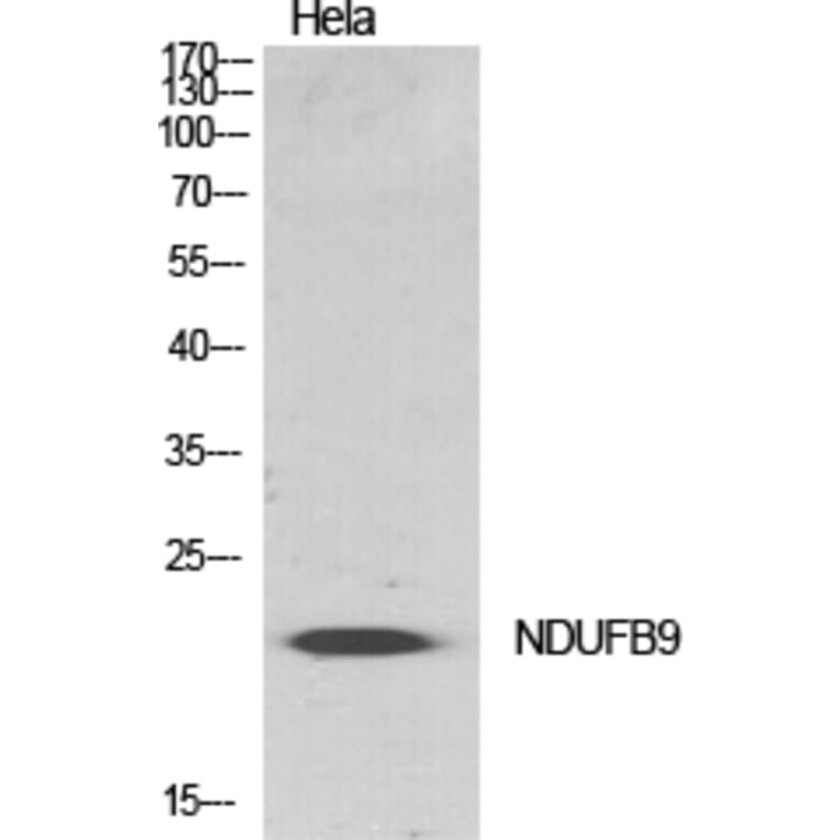 Western Blot - Anti-NDUFB9 Antibody (C16838) - Antibodies.com