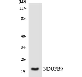 Western Blot - Anti-NDUFB9 Antibody (R12-3083) - Antibodies.com