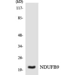 Western Blot - Anti-NDUFB9 Antibody (R12-3083) - Antibodies.com