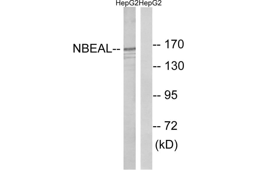Western Blot - Anti-NBEAL1 Antibody (C16920) - Antibodies.com