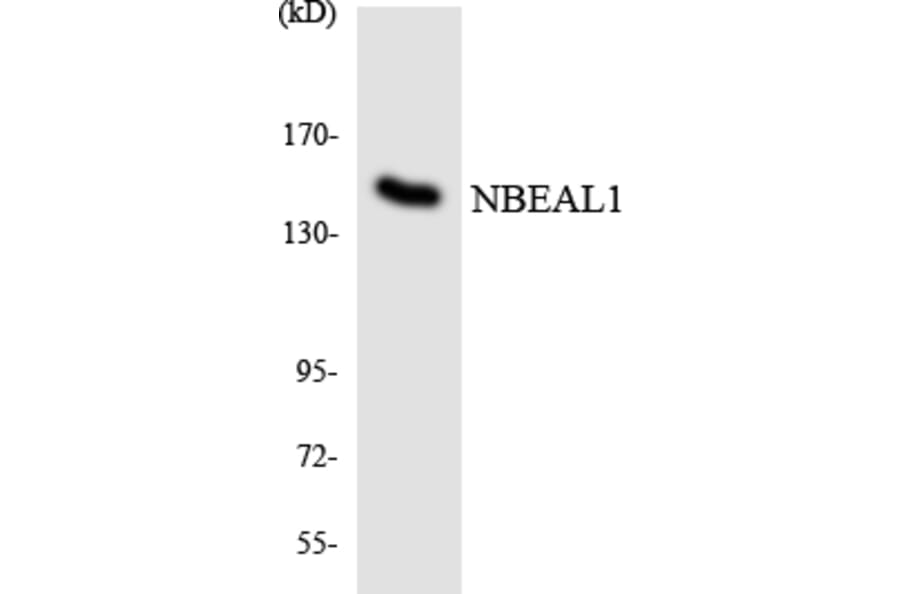 Western Blot - Anti-NBEAL1 Antibody (R12-3075) - Antibodies.com