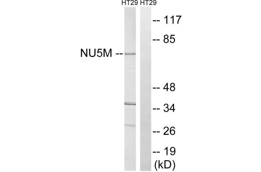 Western Blot - Anti-MT-ND5 Antibody (C16860) - Antibodies.com