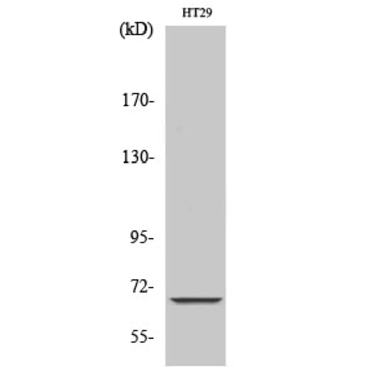 Western Blot - Anti-MT-ND5 Antibody (C16860) - Antibodies.com