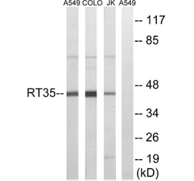 Western Blot - Anti-MRPS35 Antibody (C14043) - Antibodies.com