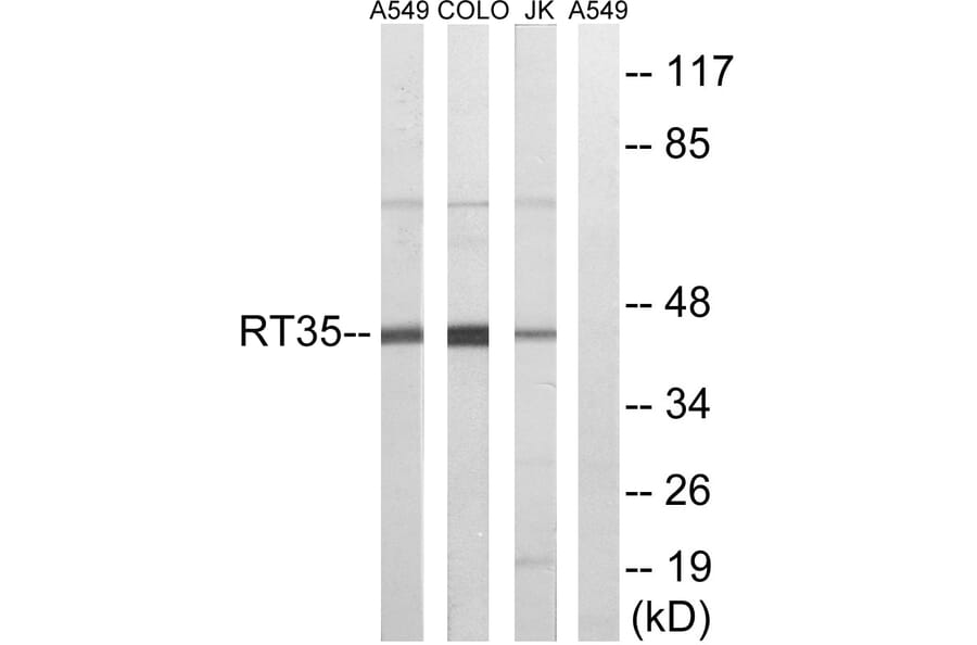 Western Blot - Anti-MRPS35 Antibody (C14043) - Antibodies.com
