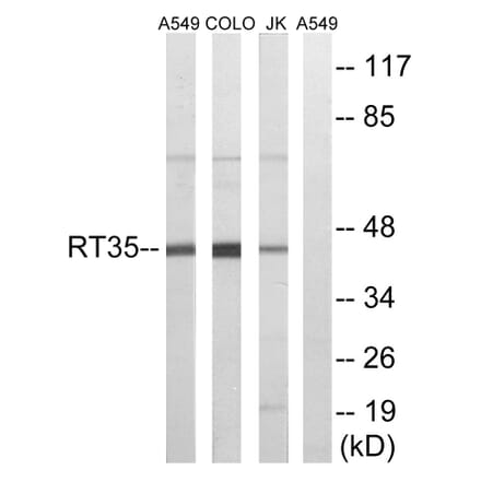 Western Blot - Anti-MRPS35 Antibody (C14043) - Antibodies.com