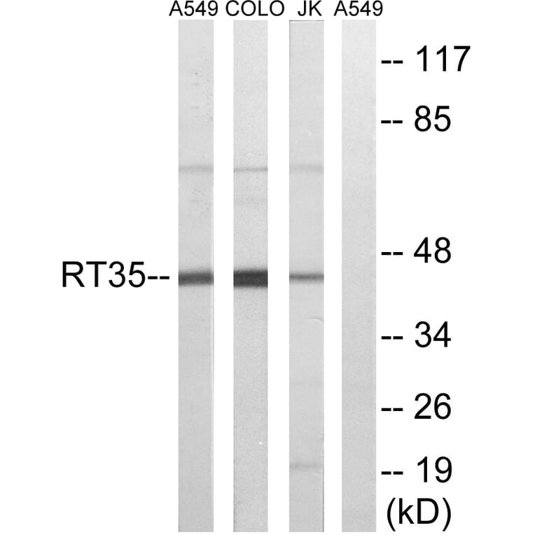 Western Blot - Anti-MRPS35 Antibody (C14043) - Antibodies.com