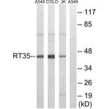 Western Blot - Anti-MRPS35 Antibody (C14043) - Antibodies.com
