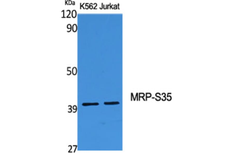 Western Blot - Anti-MRPS35 Antibody (C14043) - Antibodies.com