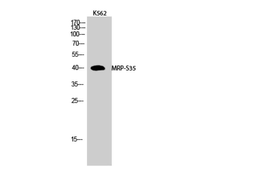 Western Blot - Anti-MRPS35 Antibody (C14043) - Antibodies.com