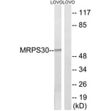 Western Blot - Anti-MRPS30 Antibody (C16659) - Antibodies.com