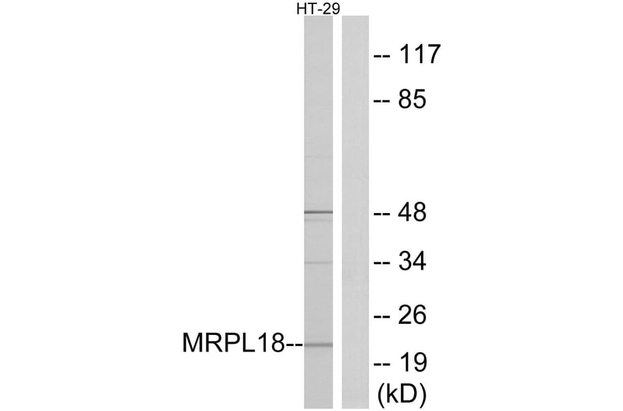 Western Blot - Anti-MRPL18 Antibody (C14062) - Antibodies.com