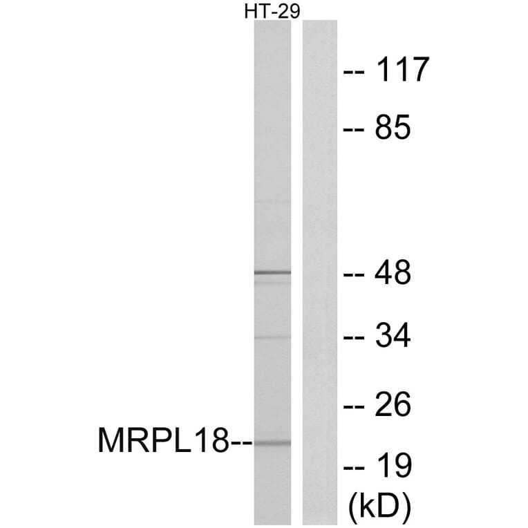 Western Blot - Anti-MRPL18 Antibody (C14062) - Antibodies.com