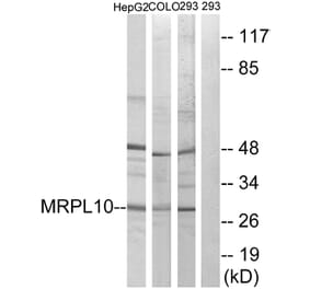 Western Blot - Anti-MRPL10 Antibody (C14054) - Antibodies.com