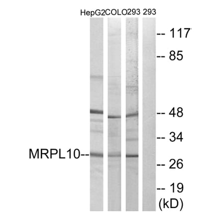 Western Blot - Anti-MRPL10 Antibody (C14054) - Antibodies.com