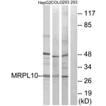 Western Blot - Anti-MRPL10 Antibody (C14054) - Antibodies.com