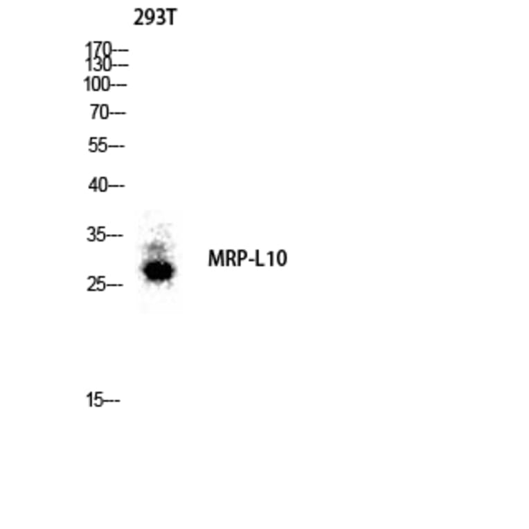 Western Blot - Anti-MRPL10 Antibody (C14054) - Antibodies.com