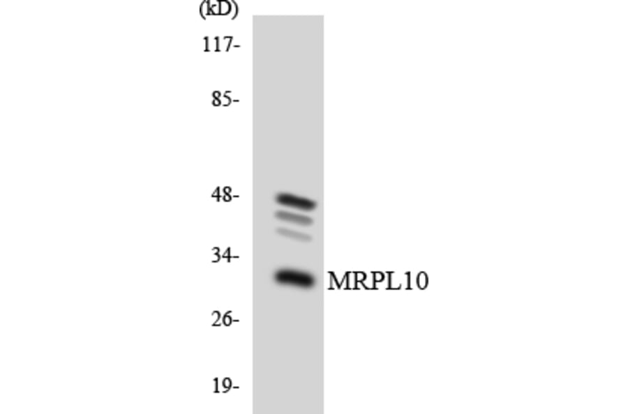 Western Blot - Anti-MRPL10 Antibody (R12-3034) - Antibodies.com