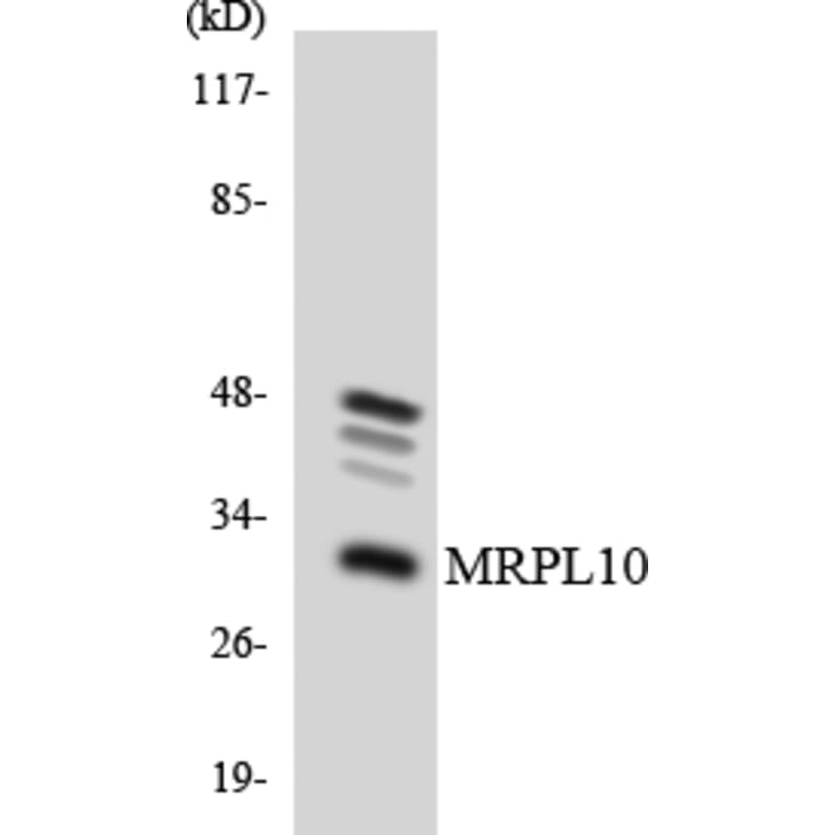 Western Blot - Anti-MRPL10 Antibody (R12-3034) - Antibodies.com