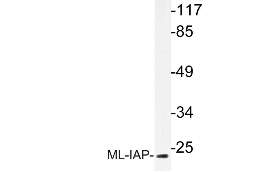 Western Blot - Anti-ML-IAP Antibody (R12-2241) - Antibodies.com