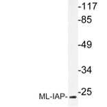 Western Blot - Anti-ML-IAP Antibody (R12-2241) - Antibodies.com