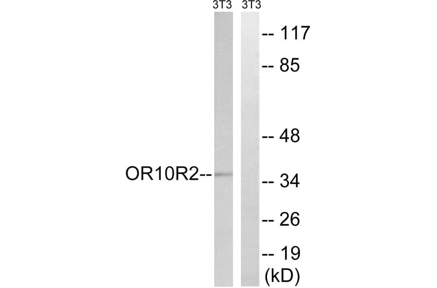 Western Blot - Anti-MAGEA5 Antibody (G875) - Antibodies.com