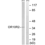 Western Blot - Anti-MAGEA5 Antibody (G875) - Antibodies.com