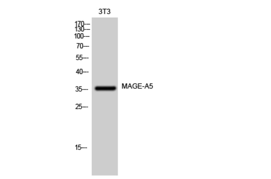 Western Blot - Anti-MAGEA5 Antibody (G875) - Antibodies.com