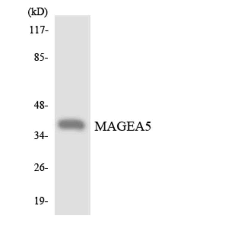 Western Blot - Anti-MAGEA5 Antibody (R12-2986) - Antibodies.com