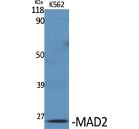 Western Blot - Anti-MAD2L1 Antibody (C21657) - Antibodies.com