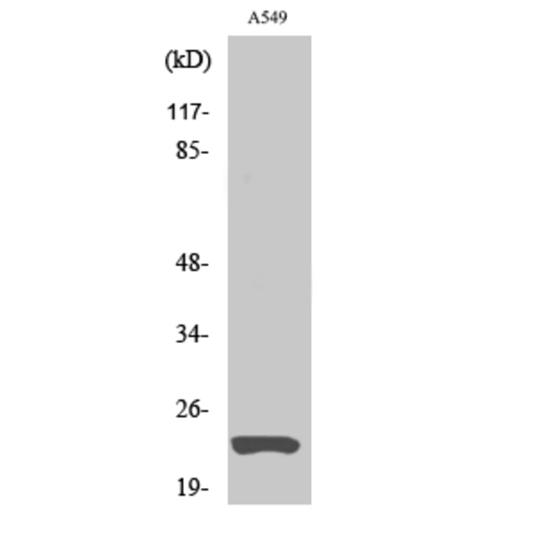 Western Blot - Anti-MAD2L1 Antibody (C21657) - Antibodies.com