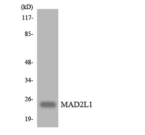 Western Blot - Anti-MAD2L1 Antibody (R12-2983) - Antibodies.com