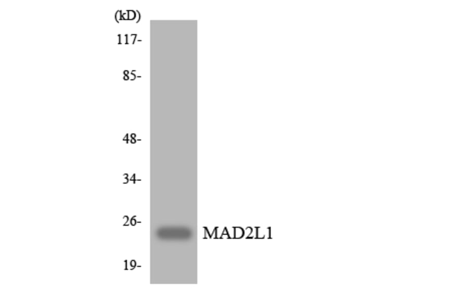 Western Blot - Anti-MAD2L1 Antibody (R12-2983) - Antibodies.com