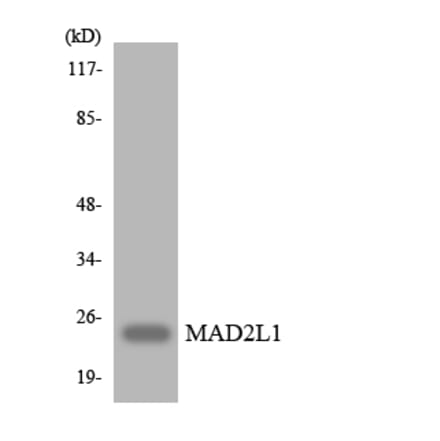 Western Blot - Anti-MAD2L1 Antibody (R12-2983) - Antibodies.com