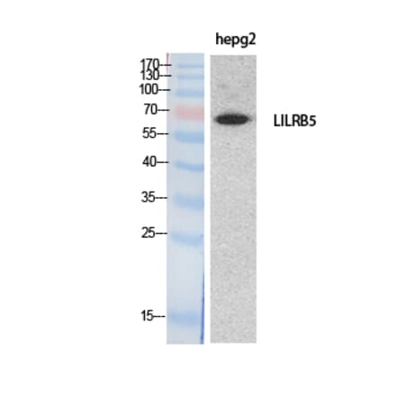 Western Blot - Anti-LILRB5 Antibody (C30388) - Antibodies.com