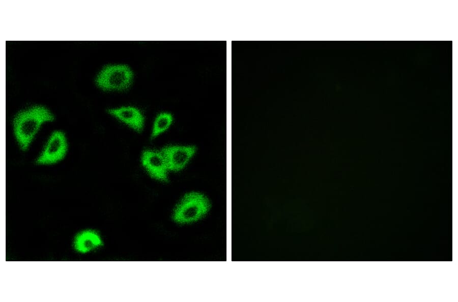 Immunofluorescence - Anti-LILRB4 Antibody (C16465) - Antibodies.com