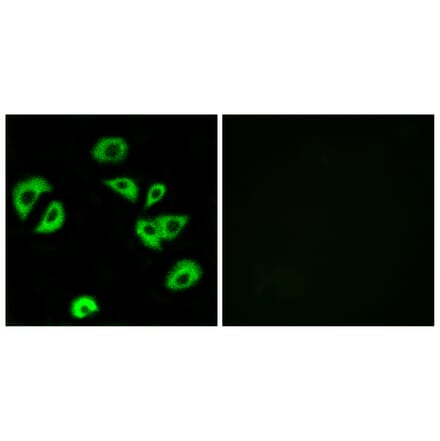 Immunofluorescence - Anti-LILRB4 Antibody (C16465) - Antibodies.com