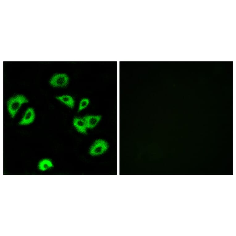 Immunofluorescence - Anti-LILRB4 Antibody (C16465) - Antibodies.com