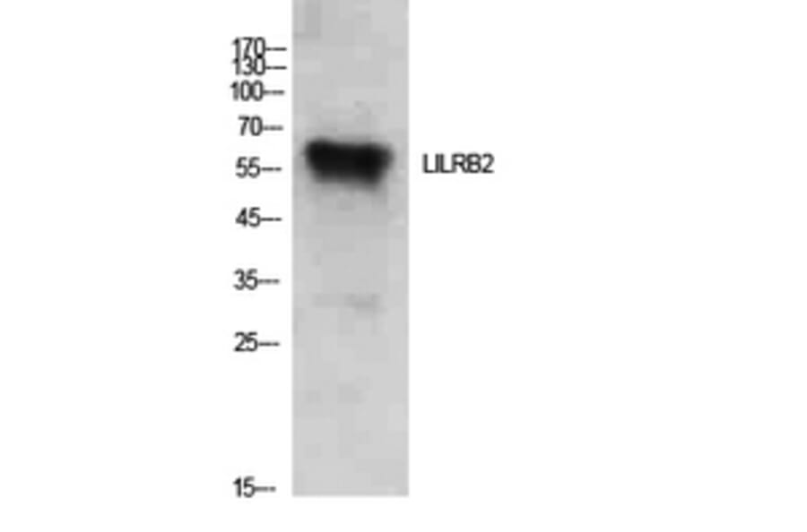 Western Blot - Anti-LILRB2 Antibody (C30389) - Antibodies.com