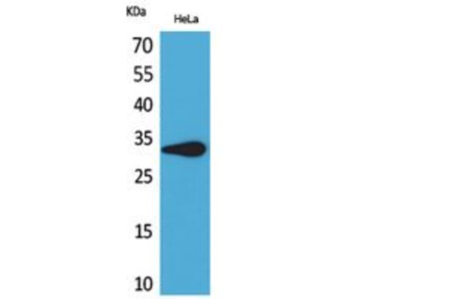 Western Blot - Anti-LILRA5 Antibody (C30391) - Antibodies.com
