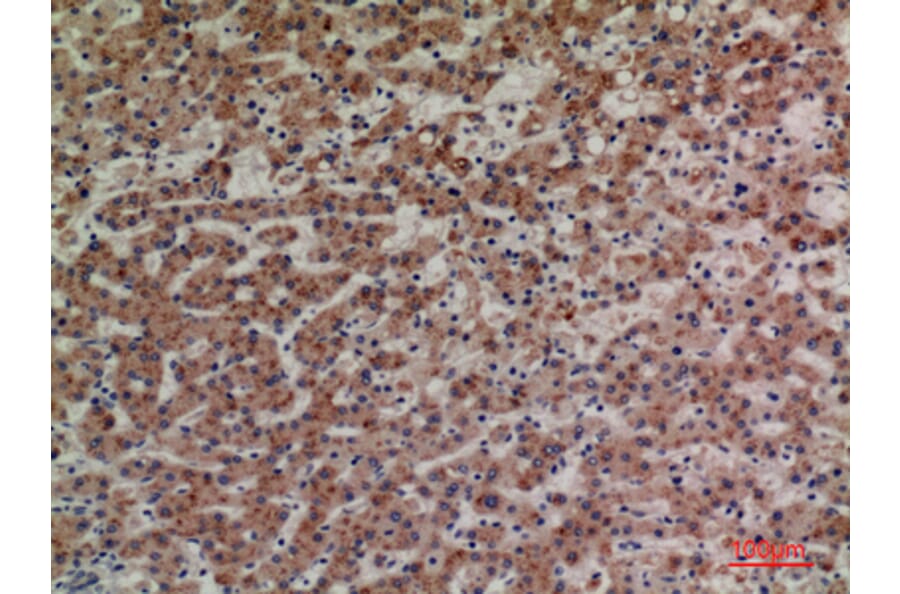 Immunohistochemistry - Anti-LILRA4 Antibody (C30392) - Antibodies.com
