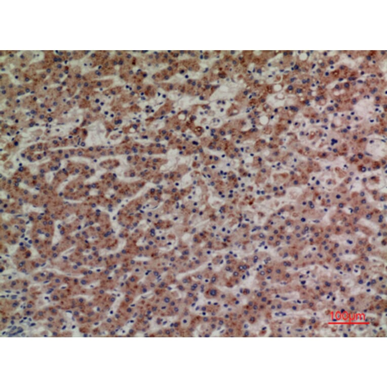 Immunohistochemistry - Anti-LILRA4 Antibody (C30392) - Antibodies.com