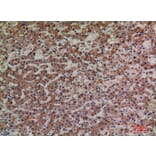 Immunohistochemistry - Anti-LILRA4 Antibody (C30392) - Antibodies.com