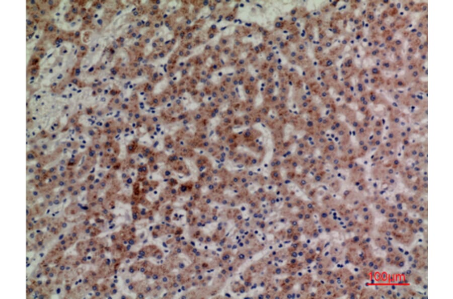 Immunohistochemistry - Anti-LILRA4 Antibody (C30392) - Antibodies.com