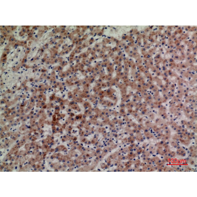 Immunohistochemistry - Anti-LILRA4 Antibody (C30392) - Antibodies.com